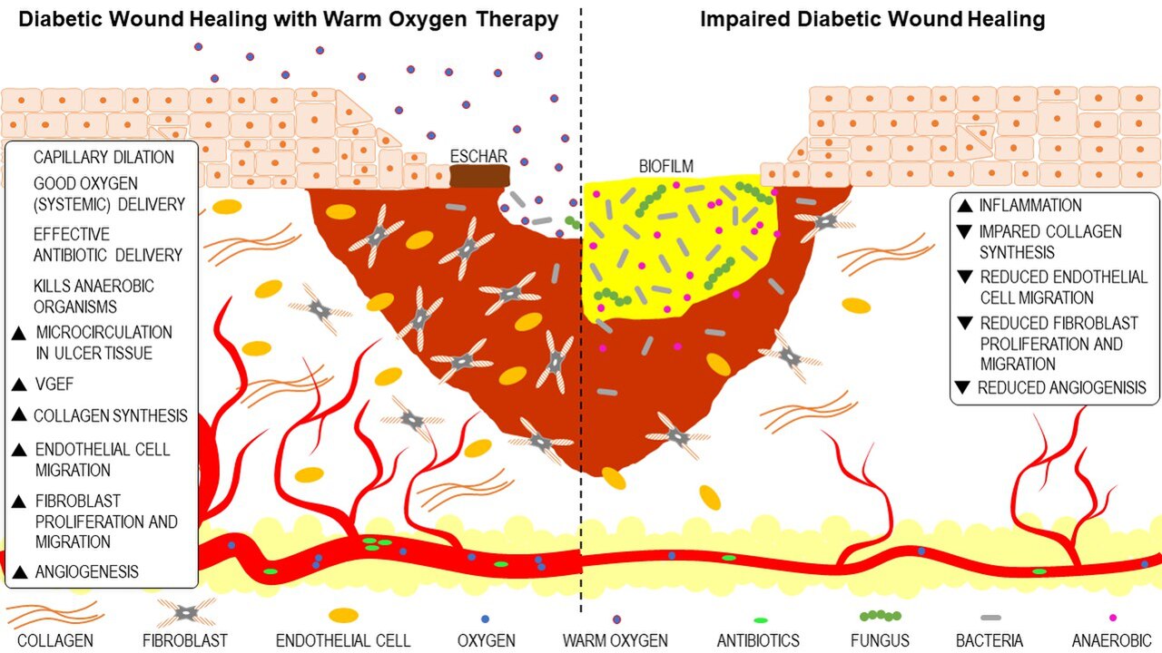 Oxygen therapy