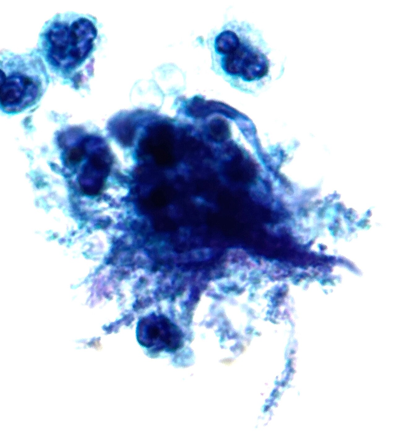 Pap test