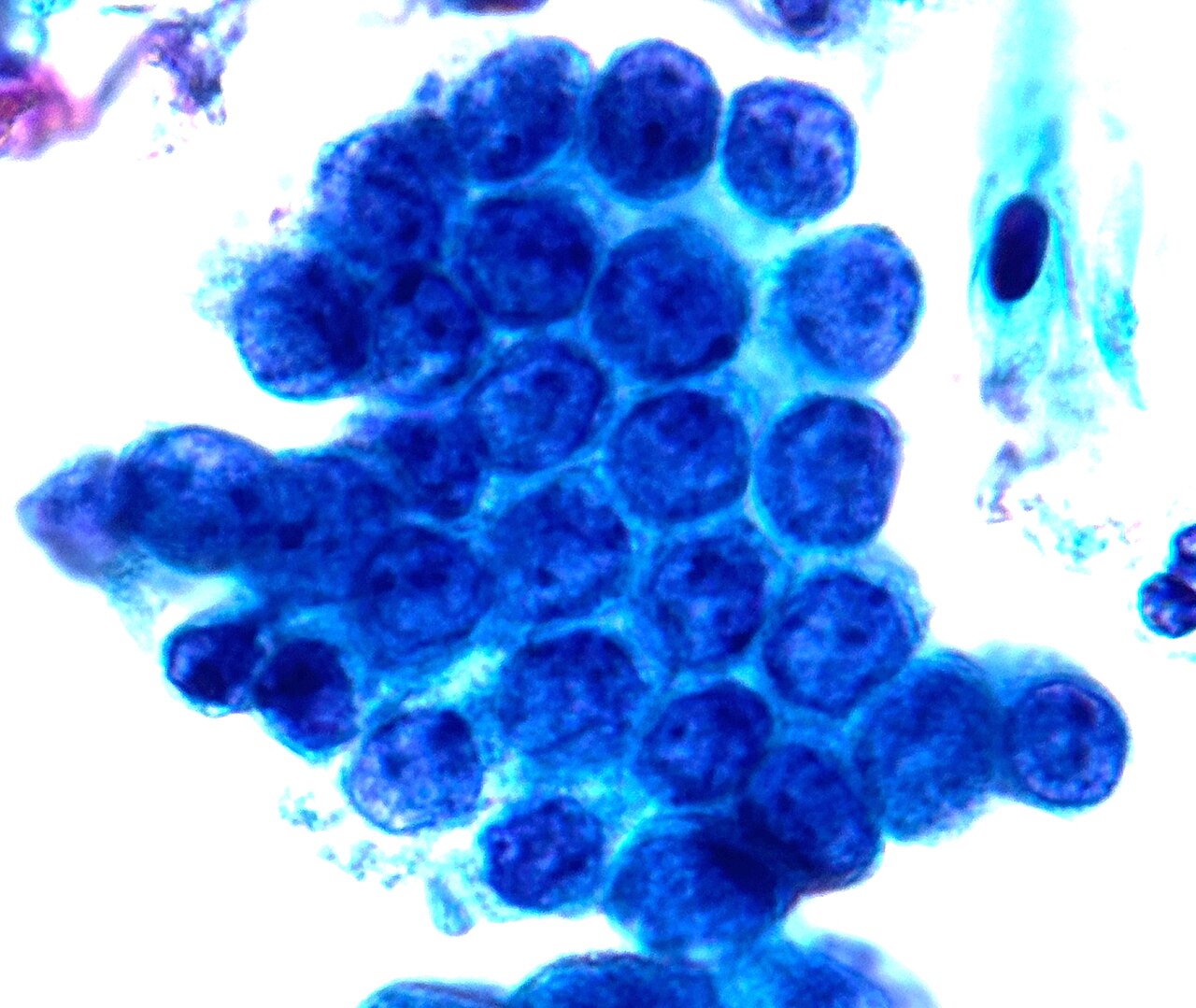 Pap test