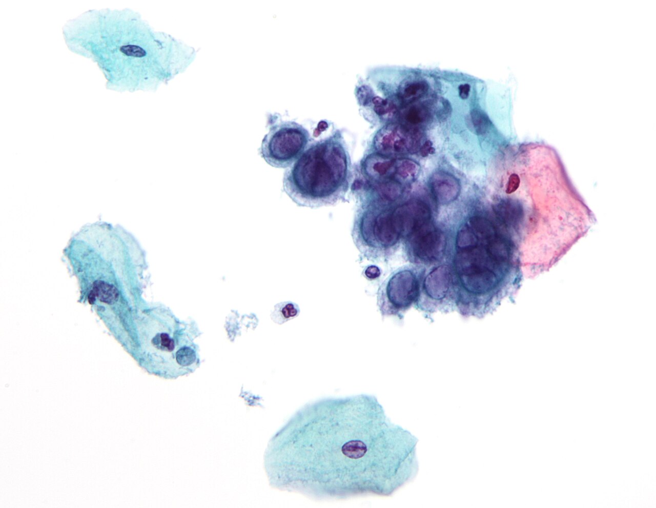 Pap test