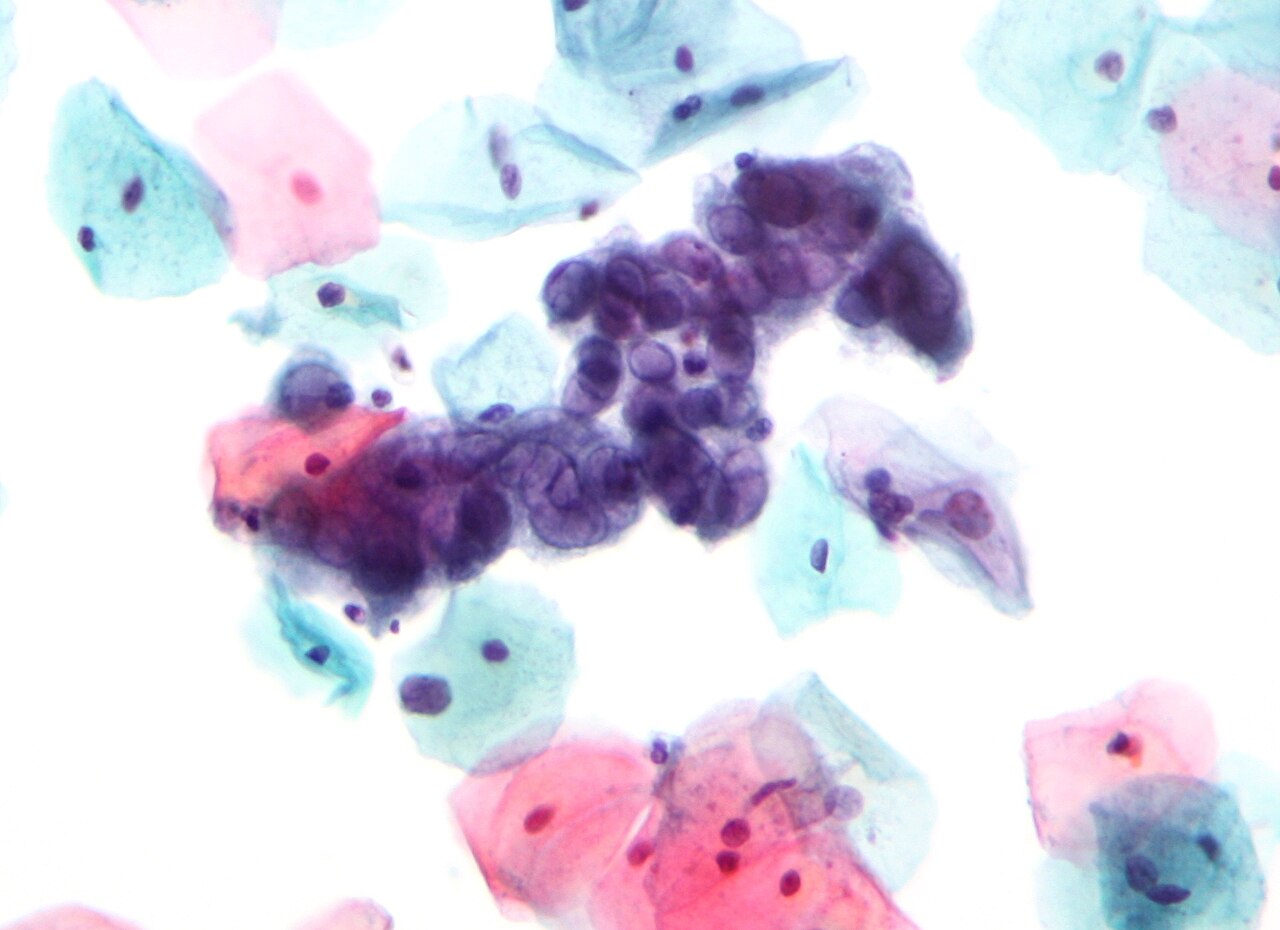Pap test