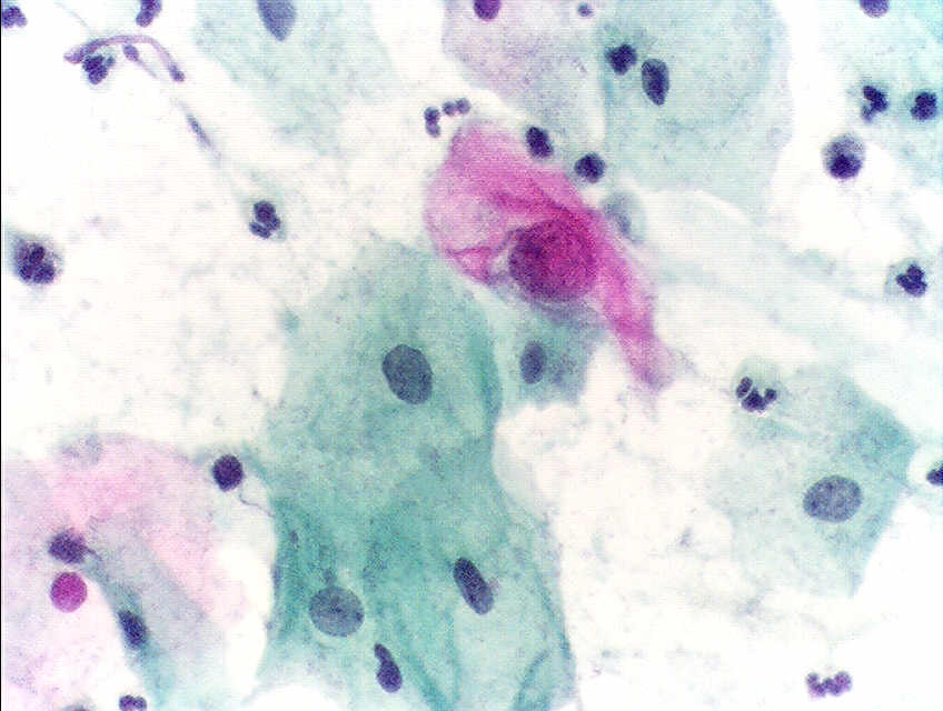 Pap test