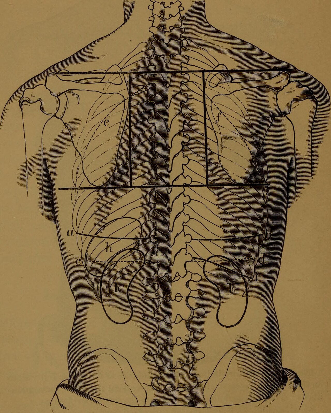 Percussion (medicine)