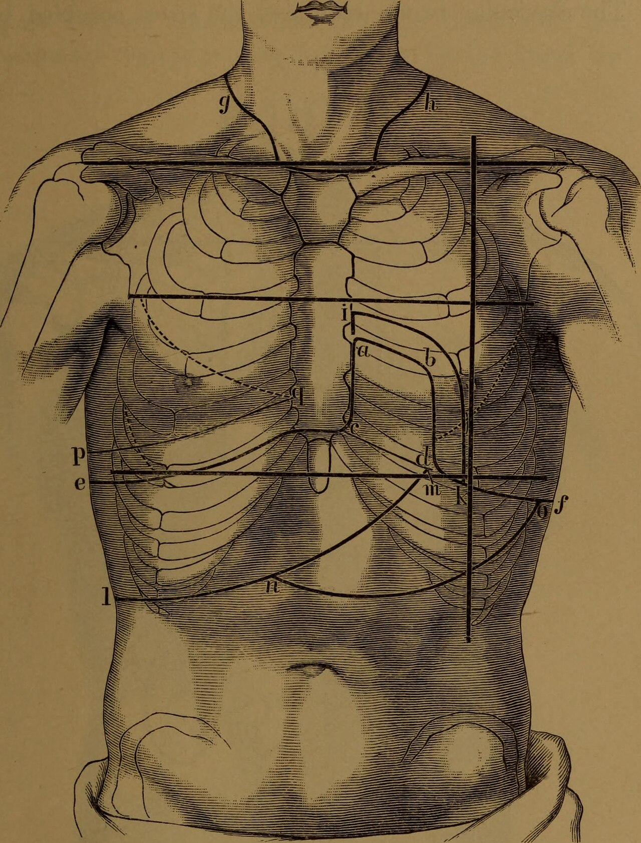 Percussion (medicine)