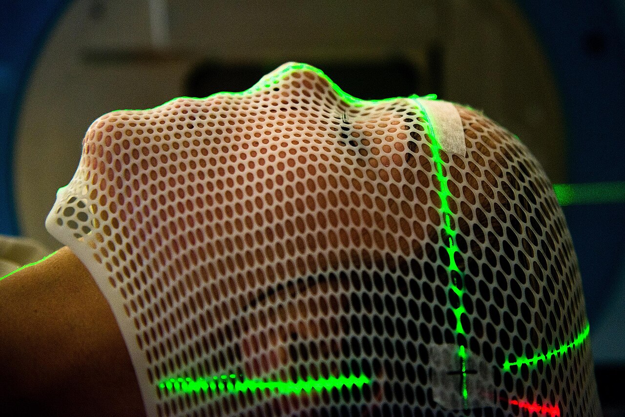 Radiation therapy
