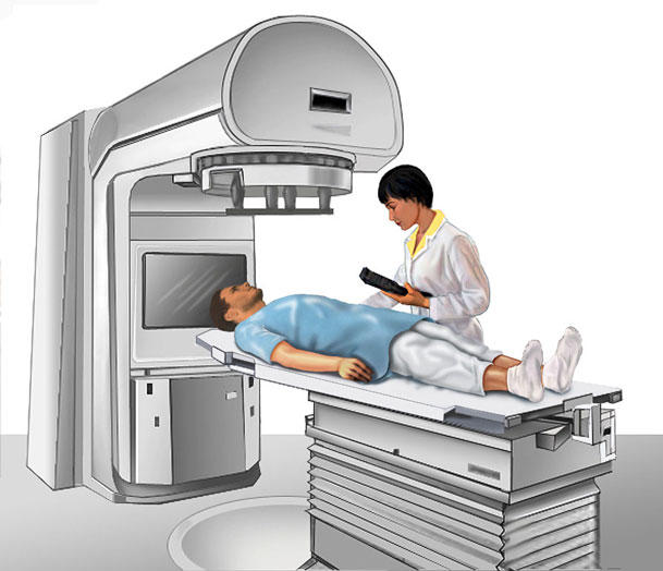 Radiation therapy